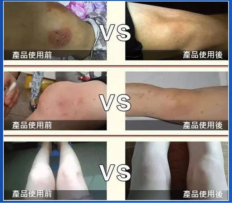 苗疆透骨膏1780896521554885.jpg 苗疆透骨膏