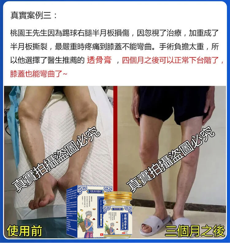 苗疆透骨膏1780896522114599.jpg 苗疆透骨膏