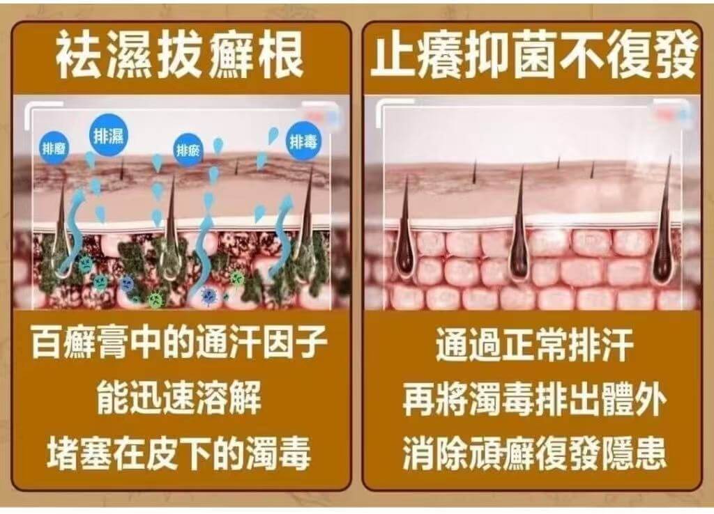 李時珍故鄉拔蘚根秘方蘚無憂百草膏